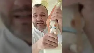 Повреждение мениска коленного сустава. Боровской Евгений — врач ортопед-травматолог