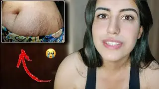 MEU CORPO 2 ANOS PÓS PARTO
