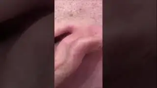 Выдавили гнойник.