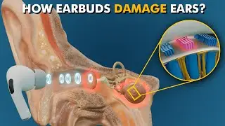 How Earbuds Damage Your Ears? (3D Animation)