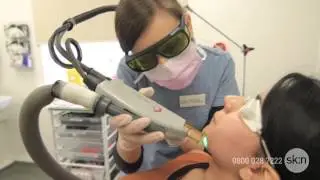 Laser Hair Removal - How does it work?