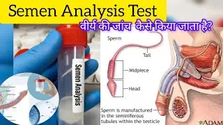 Semen Analysis test😲|Semen test kaise kiya jata hai?🤔 वीर्य की जांच #sperm#science #medical #video