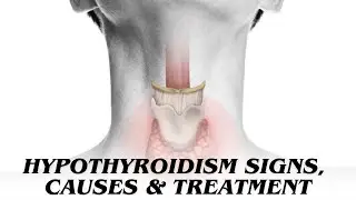 Thyroid Symptoms, Signs, Causes & Treatment