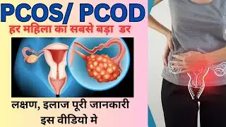 PCOD / PCOS के बारे मे पूरी जानकारी    #pcod #pcos #ovariancyst #womenhealth