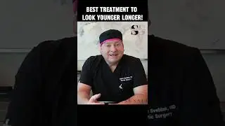 FACIAL FAT GRAFTING!