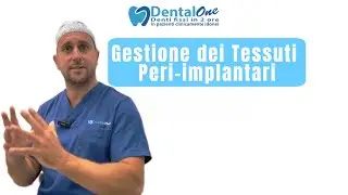 Gestione dei Tessuti Peri-implantari: l’Approccio di Dental One🦷 Dottor Vittorio Magnano