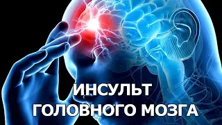 Инсульт головного мозга