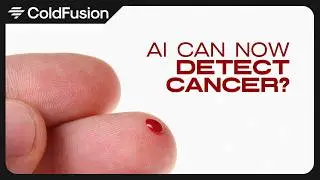 Detecting Cancer From a Drop of Blood (The Anti-Theranos)