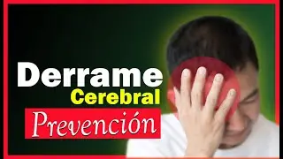 ⚠️ Prevenga el Derrame Cerebral 🧠 (Accidente Cerebrovascular ACV) 🧠 | SALUDABLEMENTE TV