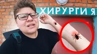 МЕНЯ УКУСИЛ КЛЕЩ🧛🏾 ИДУ В БОЛЬНИЦУ☘️ ВЫТАСКИВАЮТ КЛЕЩА☘️ ЧТО ДЕЛАТЬ, ЕСЛИ УКУСИЛ ЭНЦЕФАЛИТНЫЙ КЛЕЩ