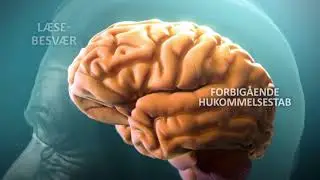 Alzheimers Sygdom (Understanding Alzheimer's Disease)