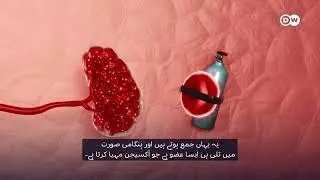جسم خون صاف کرنے کی خاطر کیا کرتا ہے؟
