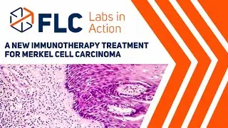 Labs In Action: A New immunotherapy Treatment for Merkel Cell Carcinoma