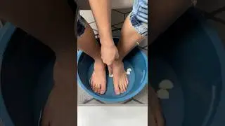 Póngase ajo en los pies y desaparecerán los hongos y las bacterias. #cocina #dicas #limpieza