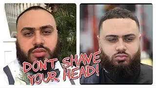 The perfect Haircut for RECEDING Men!