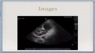 Brown EUS Case of the Month Dec 2017