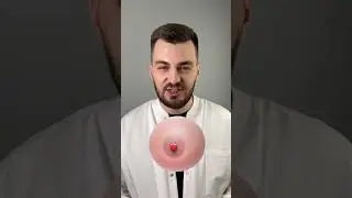 Железы Монтгомери