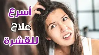9 وصفات سحرية لعلاج القشرة في الشعر من أول مره