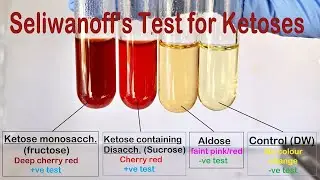 Selivanoff's Test Performance