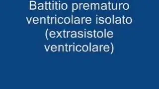 Curso de arritmias- 03- extrasistole ventricular.mov