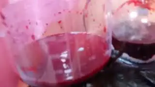 Кровопускание Головы Лечение 15 летней  головной боли Кровь разного цвета с одной головы