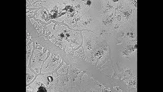 Nematodes vs Blob !