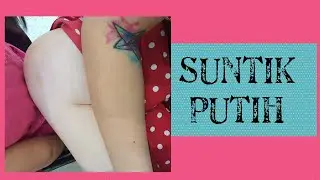 Membahas Tentang Suntik Putih alias Whitening Injection LENGKAP!!! | Olivia Rachelina Hans