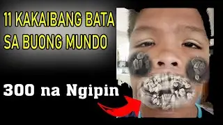 🇵🇭 ANG BATANG MARAMING NGIPIN| MGA BATANG KAKAIBA SA BUONG MUNDO