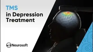 Transcranial Magnetic Stimulation (TMS) Against Depression. How does TMS Treat Depression?