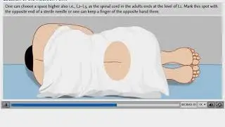 Clinical Learning - Steps Location of the insertion point