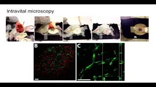 8th Annual TMII Symposium – 2018 – Session III – Nanomedicine – Alexandros Sofias, MSc