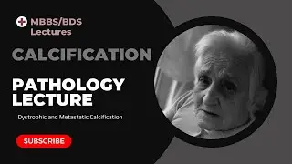 Calcification Pathology Lecture MBBS BDS Second year