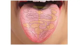 EPIGASTRIUM MANIFESTATION ON PULSE & TONGUE