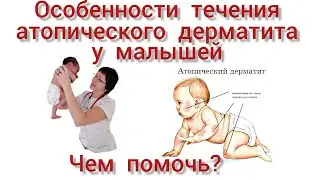 Особенности атопического дерматита у младенцев.. Как его предотвратить?