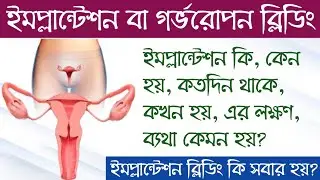 ইমপ্লান্টেশন ব্লিডিং | ইমপ্লান্টেশন ব্লিডিং কখন হয় | Implantation bleeding koto din thake