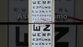 Sabías que... así es como ven las personas con astigmatismo 👀😱