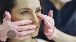 What Is Rhinoplasty?