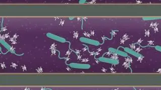 Explainer: How does cholera affect your body