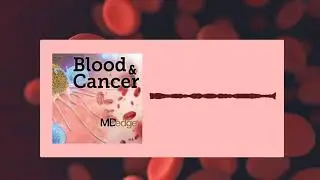 Optimizing CAR T cell therapies in lymphoma  Improving response, fighting cytokine release syndrome