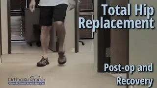 Total Hip Replacement – Post-op and Recovery - Glenn