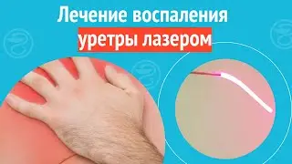 ✅ Лечение воспаления уретры лазером. Клинический случай №1225
