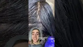 Pidocchi 