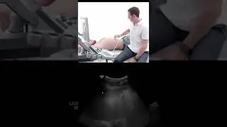 Evaluating the Left Liver Lobe Sound #shorts