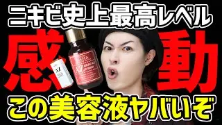 【ガチで美肌】ニキビや毛穴に悩む人必見。この美容液がオススメすぎる【コスデバハ アゼライン酸美容液】