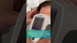 Nuevo equipo ERG en el Hospital Reina Sofía de Córdoba
