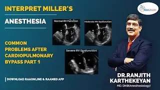 Interpret Miller's | Common problems after cardiopulmonary bypass Part 1| Raaonline