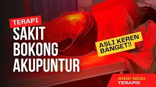 SAKIT BOKONG ‼️ AKUPUNTUR THERAPY