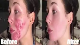High-End Skin Softening in 2 Minute or Less& Sculpting in Photoshop | 2020 | Graphics vocabulary