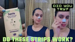 I tried Nose Strips by SANFE and results were shocking 😲 | #sanfe #removeblackheads #nosestrips