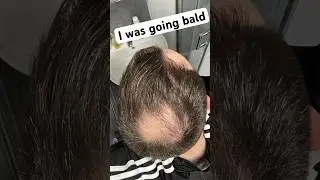 Balding Man Goes Full Joe Rogan Bald 